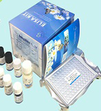 Rat Platelet antibodies IgG ELISA kit